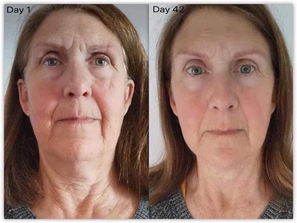 Antes y después yoga facial 6