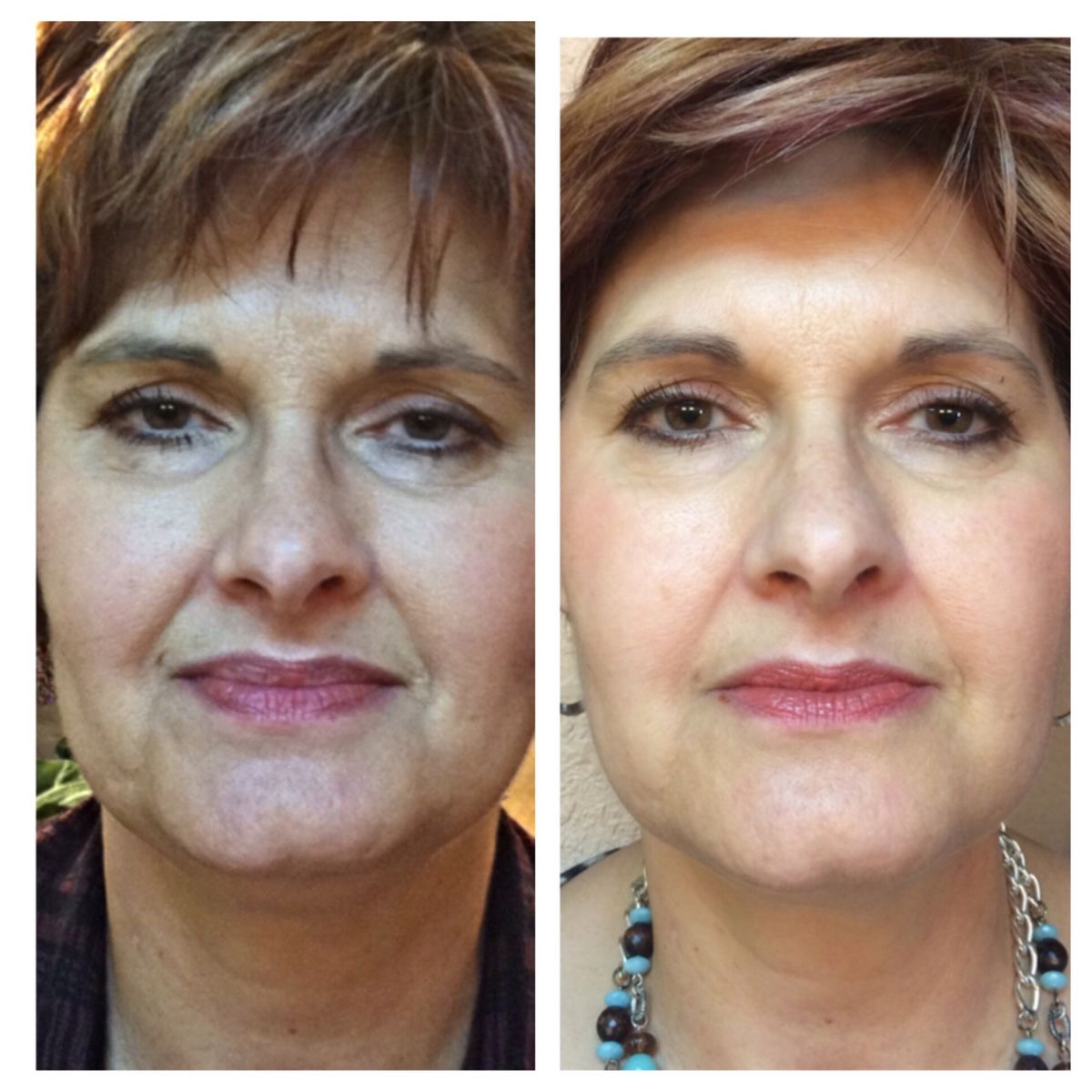Antes y después yoga facial 8
